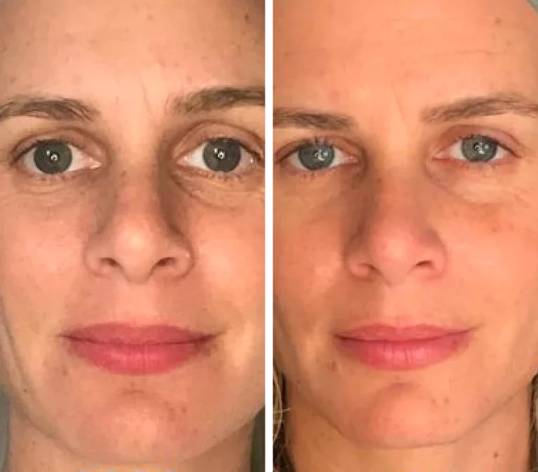 Piel de Porcelana en 10 Min - Masajeador Facial de Cristal Frío
