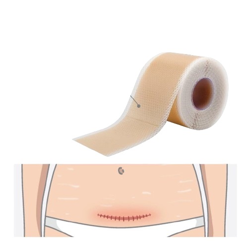 Piel Perfecta en 4 Semanas - Cinta Cicatrizante Silicona Médica